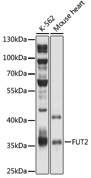 Anti-FUT2 Antibody (CAB5721)