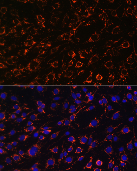 Anti-TOM20 Antibody (CAB16896)