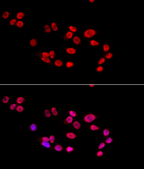 Anti-XRCC5 Antibody (CAB5862)