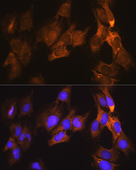 Anti-EEF1A1 Antibody (CAB0974)