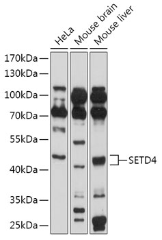 Anti-SETD4 Antibody (CAB17708)