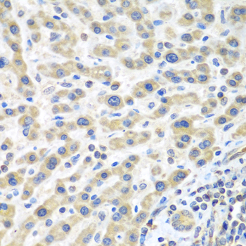 Anti-IL-2 Antibody (CAB0302)