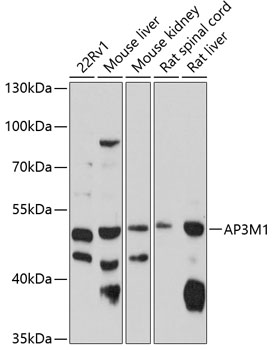 Anti-AP3M1 Antibody (CAB10410)