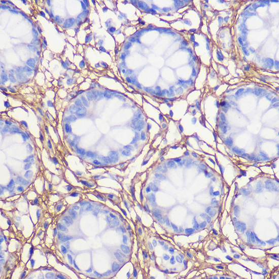 Anti-COL1A1 Antibody (CAB16891)