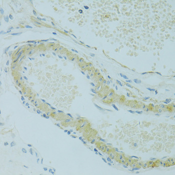 Anti-IFT57 Antibody (CAB14652)