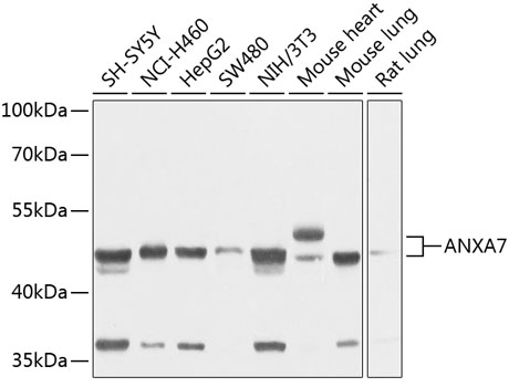 Anti-ANXA7 Antibody (CAB3733)