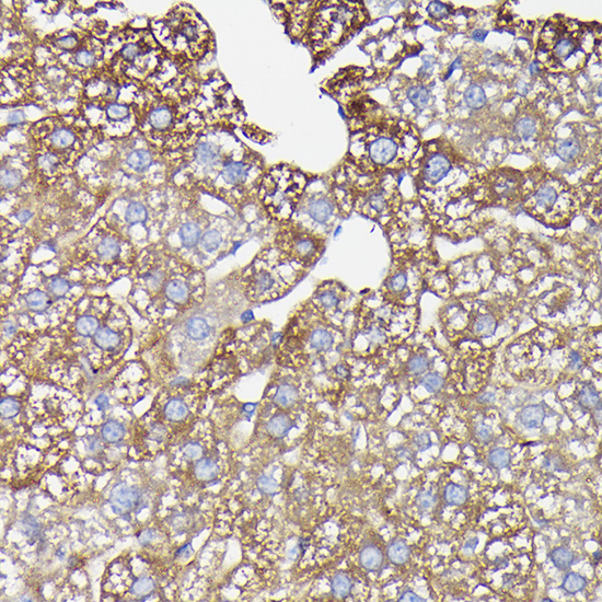 Anti-Ferritin Heavy Chain Antibody (CAB1144)