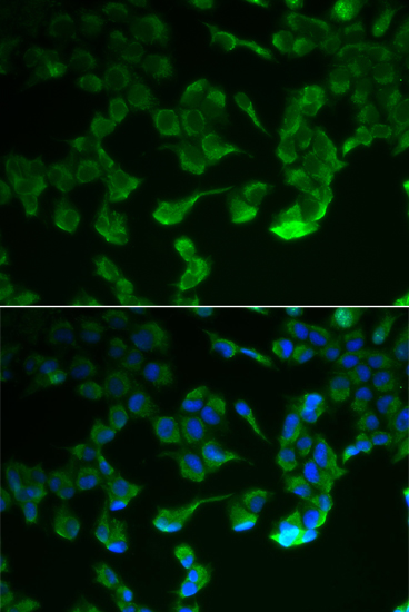 Anti-C1R Antibody (CAB6360)