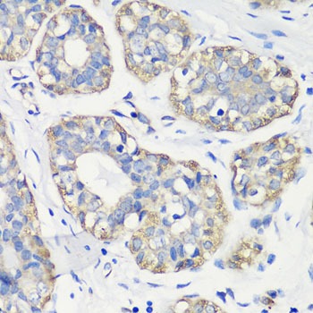 Anti-TNF-Alpha Antibody (CAB0277)