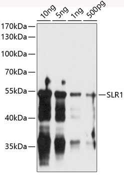 Anti-SLR1 Antibody