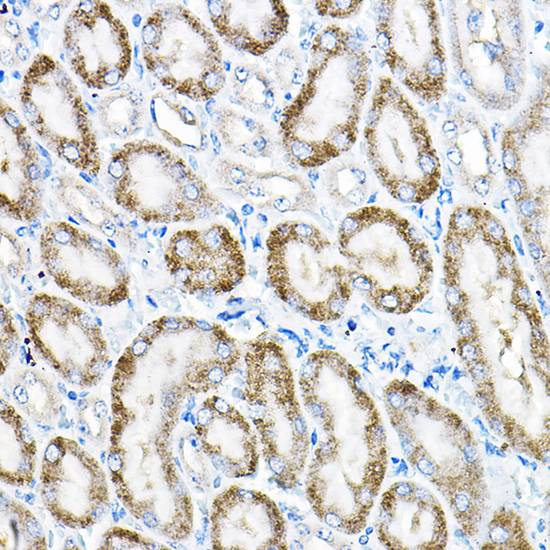 Anti-ACOX1 Polyclonal Antibody (CAB8091)