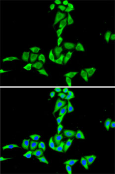 Anti-CES2 Antibody (CAB13640)