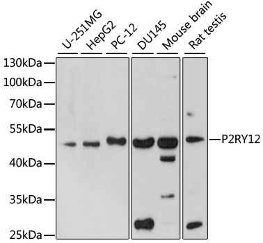 Anti-P2RY12 Antibody (CAB1710)