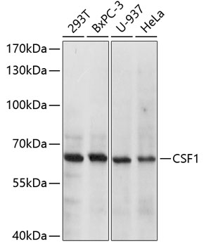 Anti-CSF1 Antibody (CAB10854)