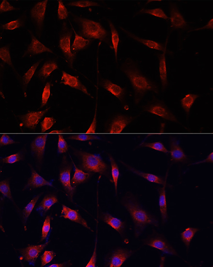 Anti-Smad2 Antibody [KO Validated] (CAB7699)