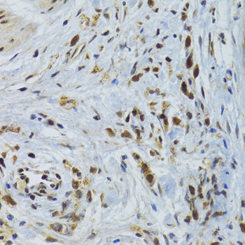 Anti-GABPB1 Antibody (CAB6909)