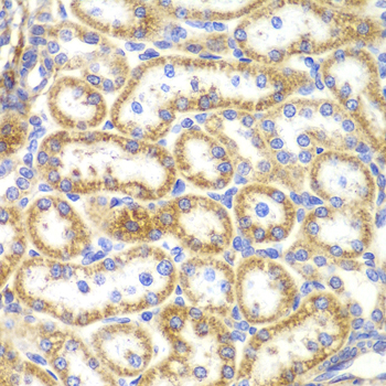 Anti-RANKL Antibody (CAB13567)