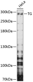 Anti-TG Antibody (CAB11708)