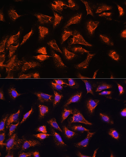 Anti-OCIAD2 Antibody (CAB14962)