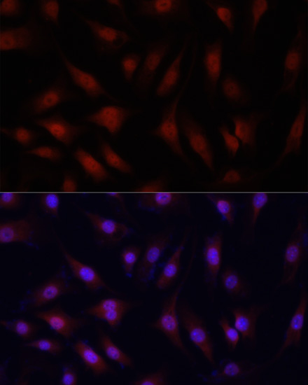 Anti-YAP1 Antibody (CAB11265)