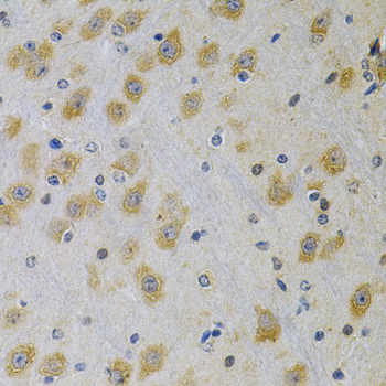 Anti-IGFBP4 Antibody (CAB2008)