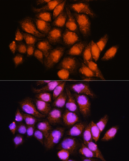 Anti-ADK Antibody (CAB15024)