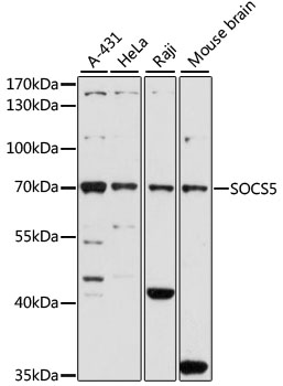 Anti-SOCS5 Antibody (CAB7952)