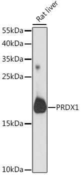 Anti-PRDX1 Antibody (CAB16412)