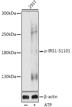 Anti-Phospho-IRS1-S1101 pAb (CABP0867)