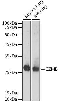 Anti-GZMB Antibody (CAB2557)