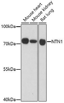 Anti-NTN1 Antibody (CAB16236)