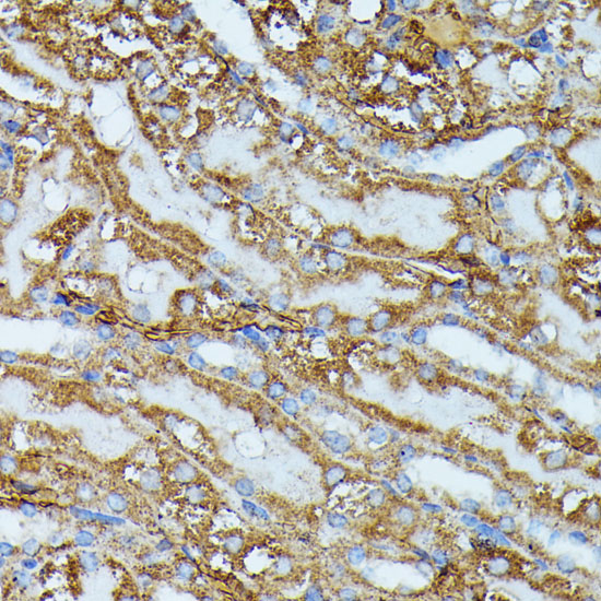 Anti-IVD Antibody (CAB15281)