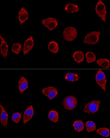 Anti-DAO Antibody (CAB5309)