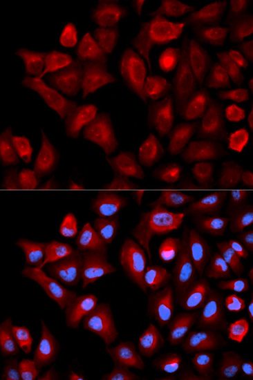 Anti-TBRG4 Antibody (CAB0276)