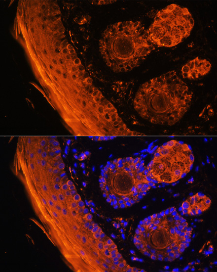 Anti-TGM1 Antibody (CAB13359)