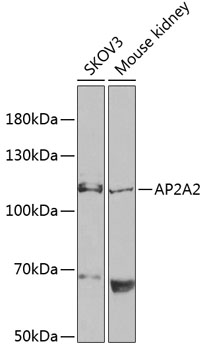 Anti-AP2A2 Antibody (CAB13274)