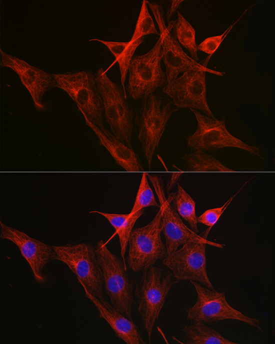 Anti-Beta-Tubulin Mouse Monoclonal Antibody (CABC021)