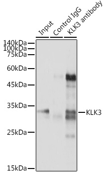 Anti-KLK3 Antibody (CAB2052)