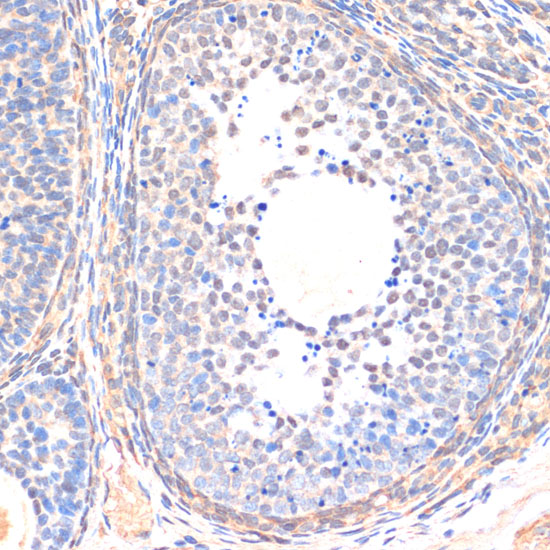 Anti-Smad5 Antibody (CAB14023)