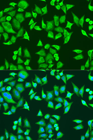 Anti-SMN2 Antibody (CAB12519)