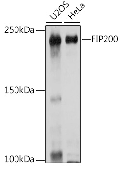 Anti-FIP200 Antibody (CAB14685)