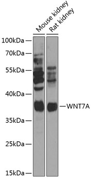 Anti-WNT7A Antibody (CAB14194)