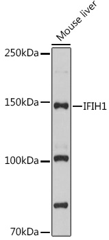 Anti-IFIH1 Antibody (CAB13645)