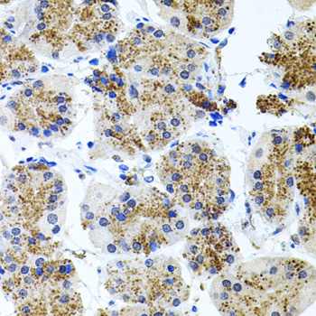 Anti-SSTR2 Antibody (CAB3135)