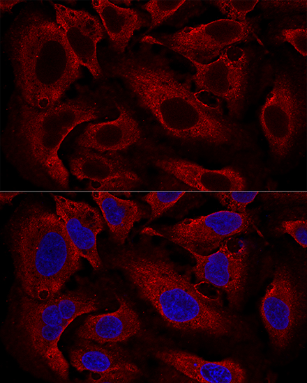 Anti-ARL8B Polyclonal Antibody (CAB8869)