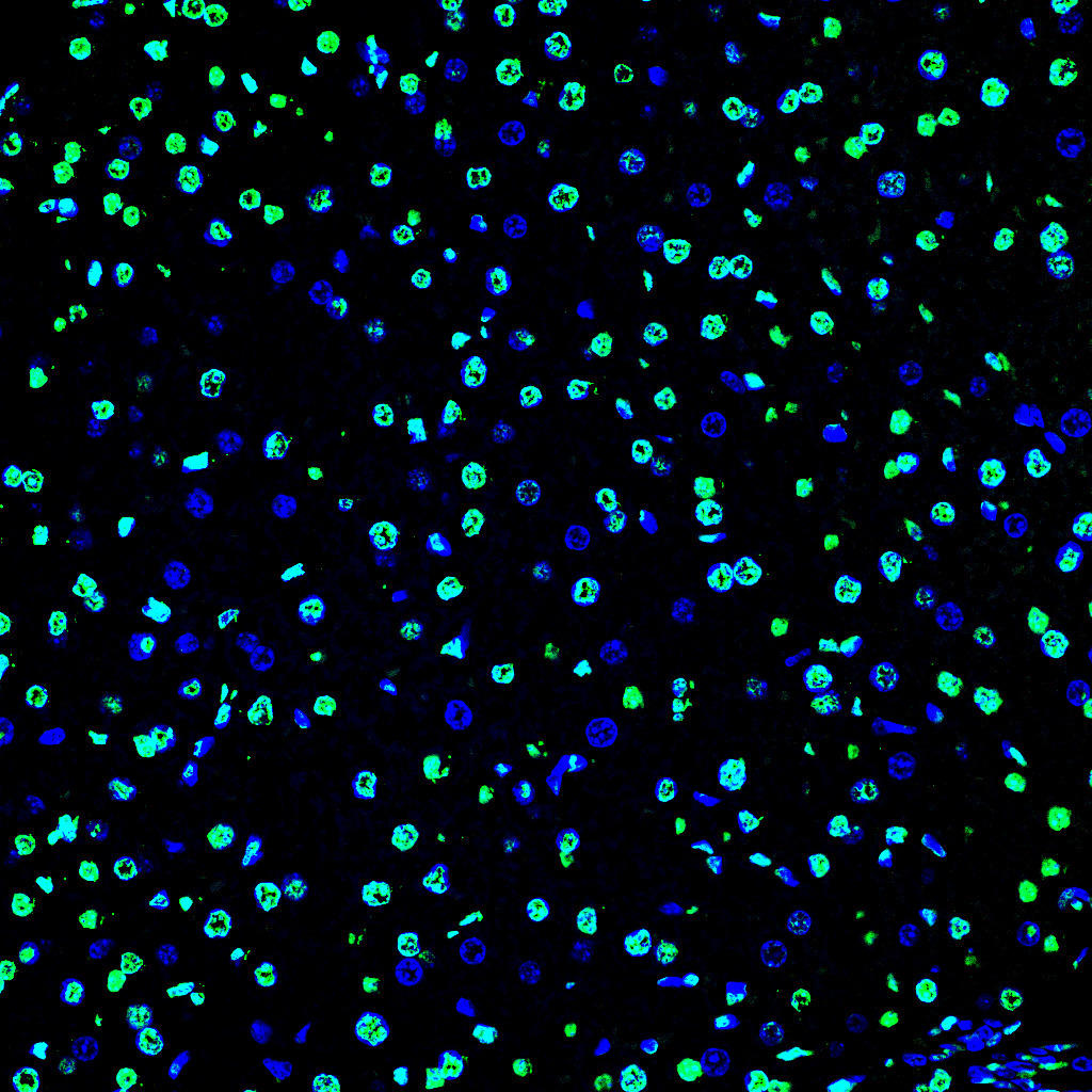 Paraffin embedded mouse liver was treated with DNase I to fragment the DNA. DNA strand breaks showed intense fluorescent staining in DNase I treated sample (green). The cells were counterstained with DAPI (blue).This photo was taken by confocal microscope