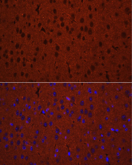 Anti-STXBP1 Antibody (CAB5420)