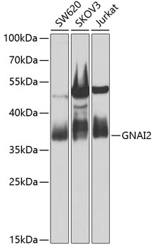 Anti-GNAI2 Antibody (CAB14204)