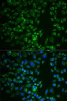 Anti-DMP1 Antibody (CAB11076)