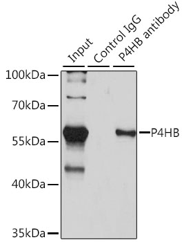 Anti-P4HB Antibody [KO Validated] (CAB0692)